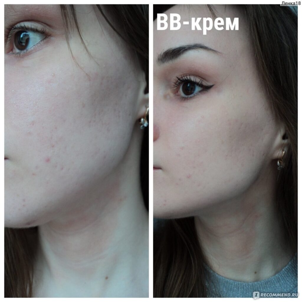 В.