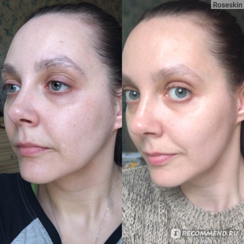 Krem dlailцa medi-peel bor-tox peptide peptide cream-«poTrAyAsAющIй ...