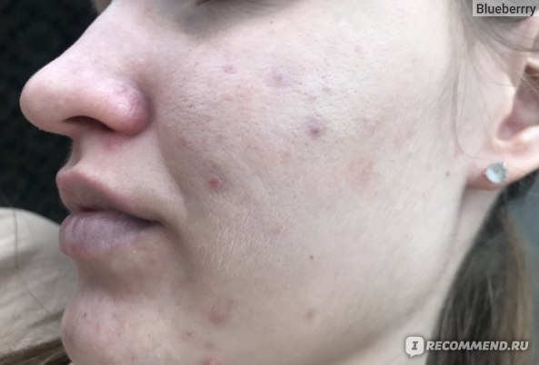 Крреот в Рунбакси иикс -деарме - «Бедж